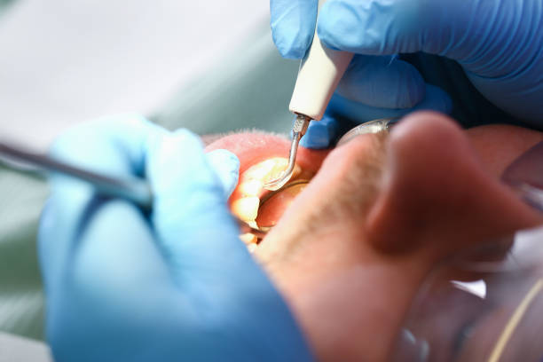 Best Dentist for Dental Trauma  in Brunswick, OH