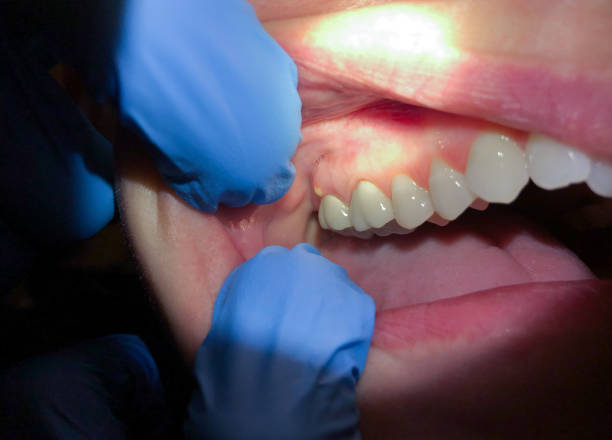 Best Knocked-Out Tooth Emergency  in Brunswick, OH