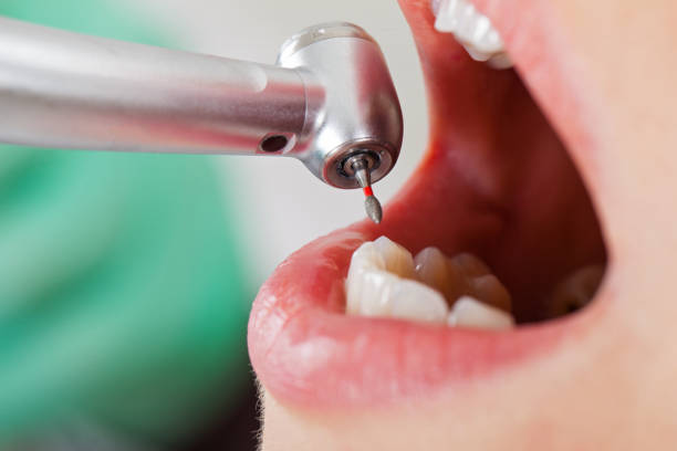 Dentist for Dental Trauma in OH